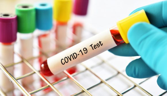 test-farmacie-Covid-19