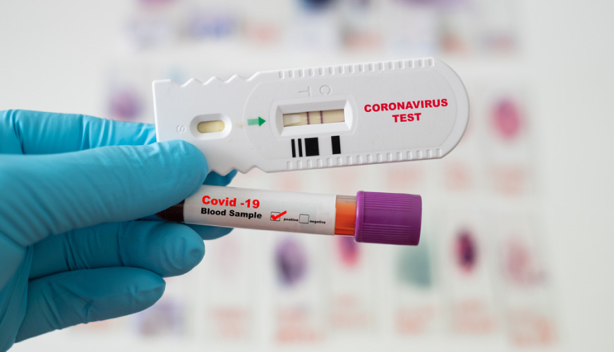 test-rapidi-farmacia-garantiti-tracciamento-sicurezza